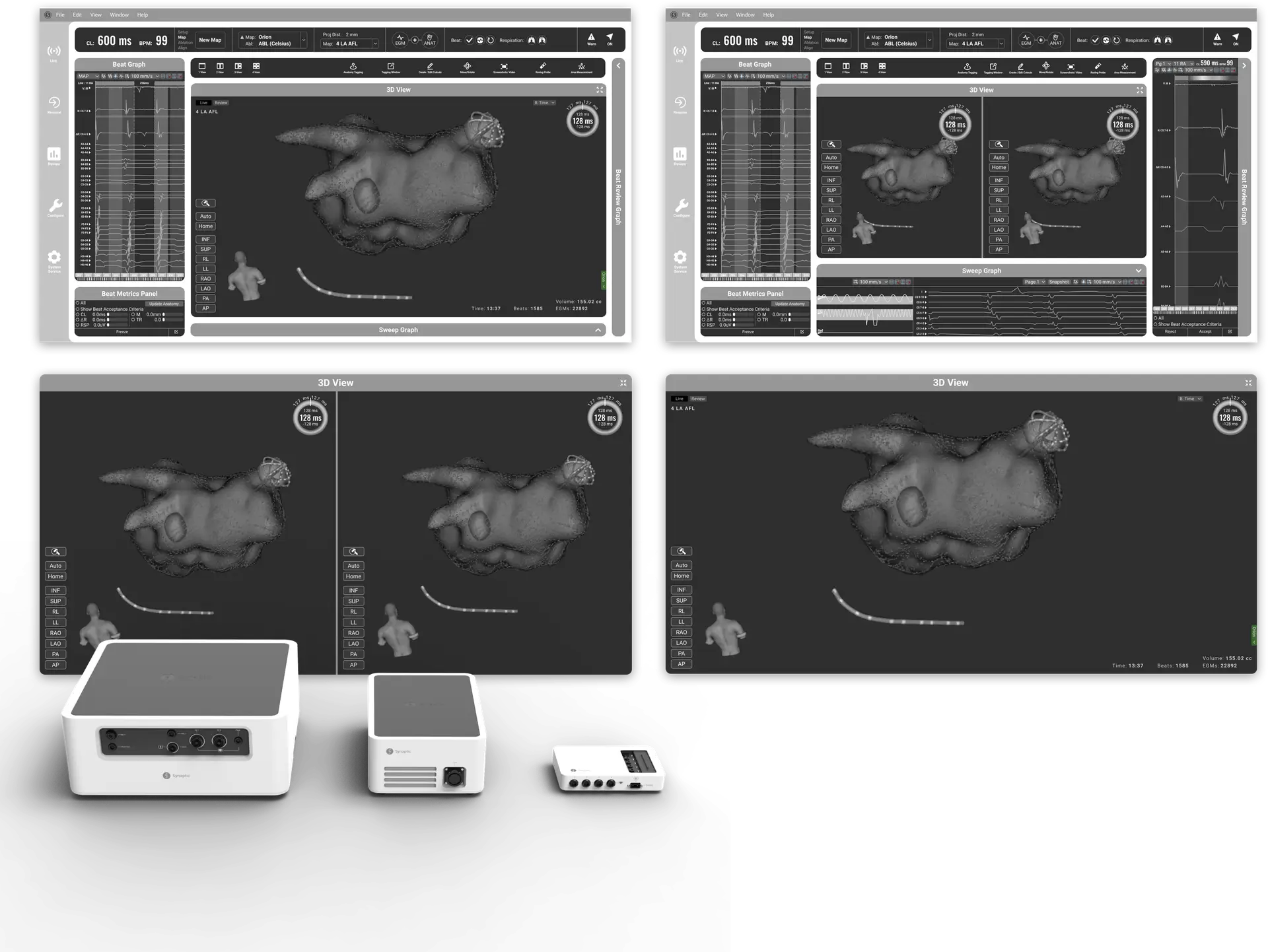 Synaptic Cryoablation Heart Monitor UI