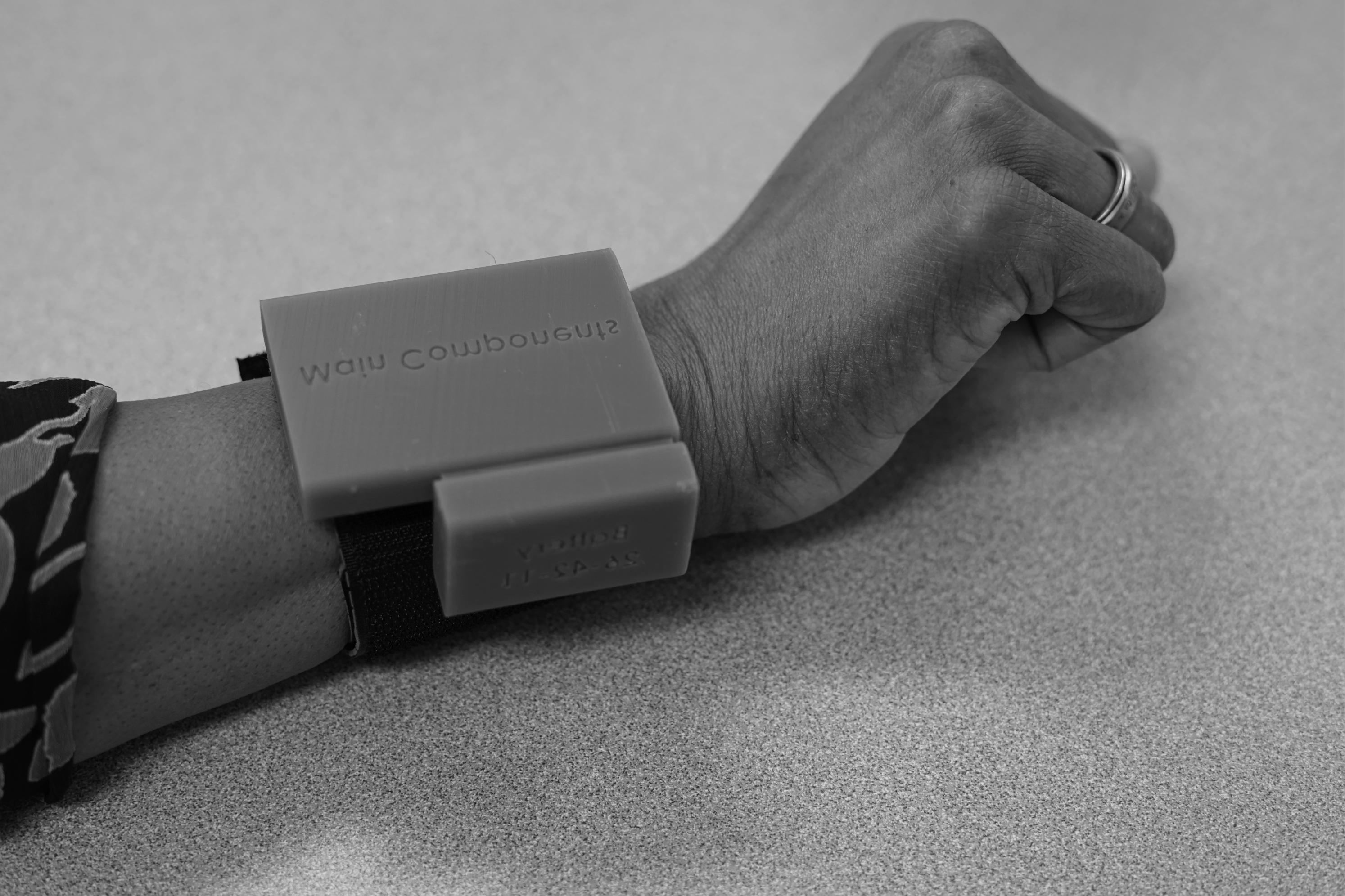 Prototype of the Sotera Wireless health device worn on the wrist.