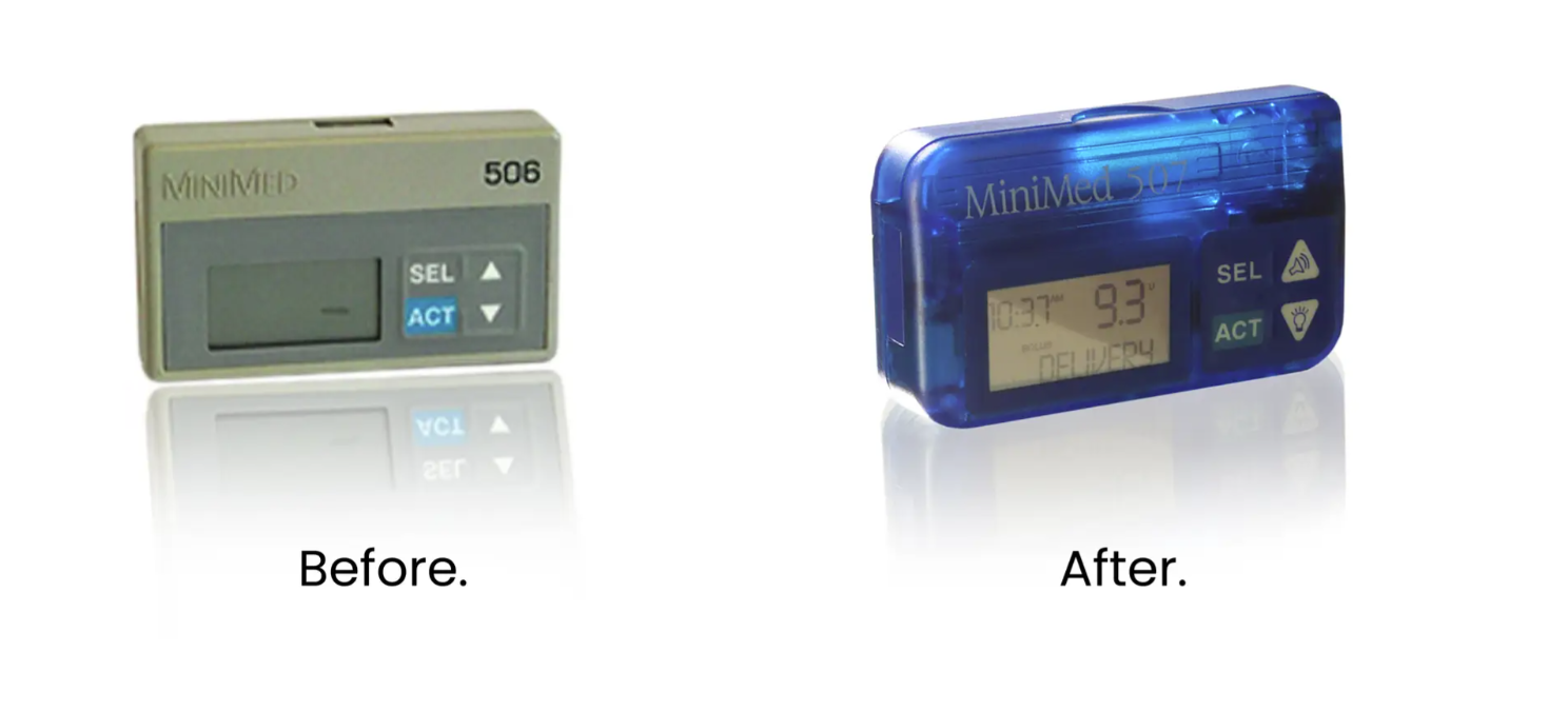 Side-by-side comparison of two insulin pumps: on the left, an older, gray MiniMed 506 labeled “Before”; on the right, a newer, translucent blue MiniMed device labeled “After.”.